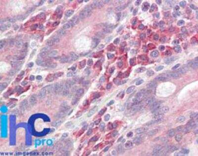 Immunohistochemistry-Paraffin: LAT Antibody [NBP2-27104]