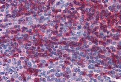 Immunohistochemistry-Paraffin: LAT Antibody (LAT.10-17) - BSA Free [NBP2-00289]