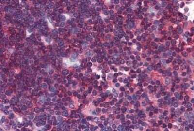 Immunohistochemistry-Paraffin: LAT Antibody (LAT.10-17) - BSA Free [NBP2-00289]