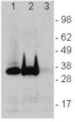 Western Blot: LAT Antibody (LAT.10-17)BSA Free [NBP2-00289]