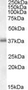 Western Blot: LAT Antibody [NB100-1441]