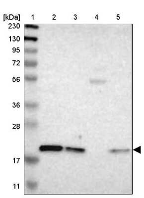 Western Blot: LAT Antibody [NBP1-81324]