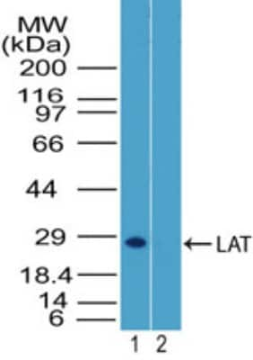 Western Blot: LAT Antibody [NBP2-27104]