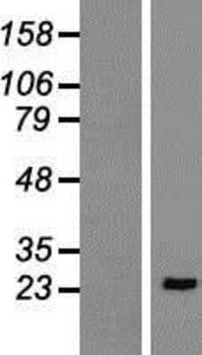 Western Blot: LAT Overexpression Lysate [NBP2-09156]