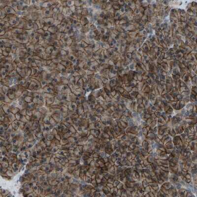 Immunohistochemistry-Paraffin: LAT3 Antibody [NBP1-87331]