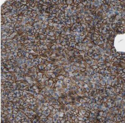Immunohistochemistry-Paraffin: LAT3 Antibody [NBP1-87332]