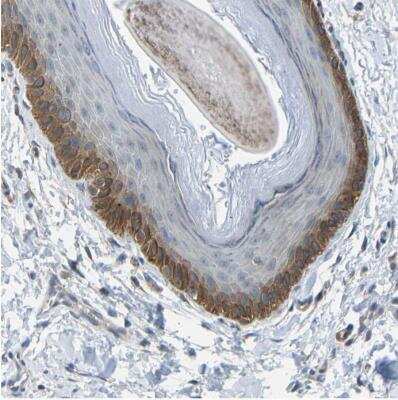 Immunohistochemistry-Paraffin: LAT3 Antibody [NBP1-87332]