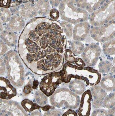 Immunohistochemistry-Paraffin: LAT3 Antibody [NBP1-87332]