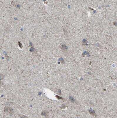 Immunohistochemistry-Paraffin: LAT3 Antibody [NBP1-87332]