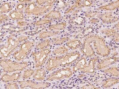 Immunohistochemistry-Paraffin: LAT3 Antibody [NBP2-98543]