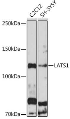 Western Blot: LATS1 AntibodyAzide and BSA Free [NBP3-05224]