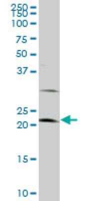 Western Blot: LATS1 Antibody (3A7) [H00009113-M09]