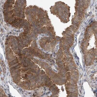 Immunohistochemistry-Paraffin: LATS1 Antibody [NBP1-86860]