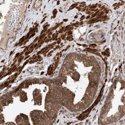 Immunohistochemistry-Paraffin: LATS1 Antibody [NBP1-86860]