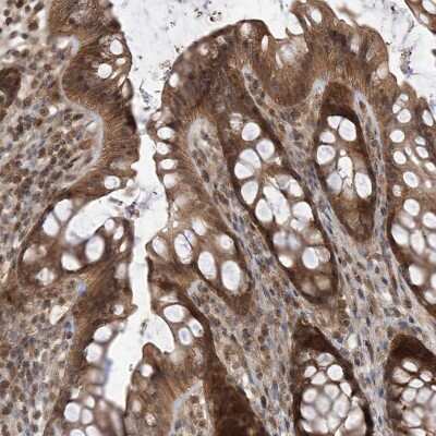 Immunohistochemistry-Paraffin: LATS1 Antibody [NBP1-86860]
