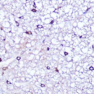 Immunohistochemistry-Paraffin: LATS1 Antibody - Azide and BSA Free [NBP3-05224]