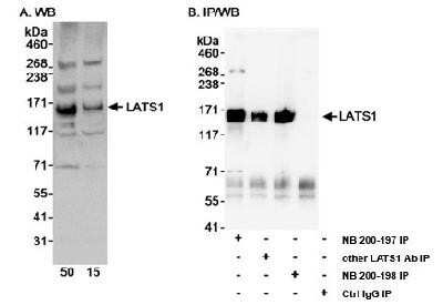 Western Blot: LATS1 Antibody [NB200-197]