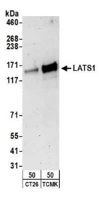 Western Blot: LATS1 Antibody [NB200-197]