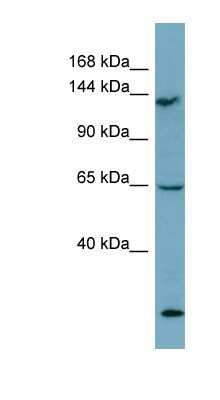 Western Blot: LATS1 Antibody [NBP1-58271]