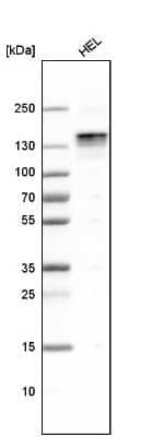 Western Blot: LATS1 Antibody [NBP1-86860]