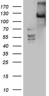 Western Blot: LATS2 Antibody (OTI2D3) [NBP2-45612]