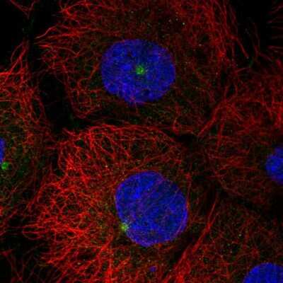 Immunocytochemistry/ Immunofluorescence: LATS2 Antibody [NBP2-55084]