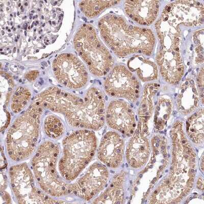 Immunohistochemistry-Paraffin: LATS2 Antibody [NBP2-14184]