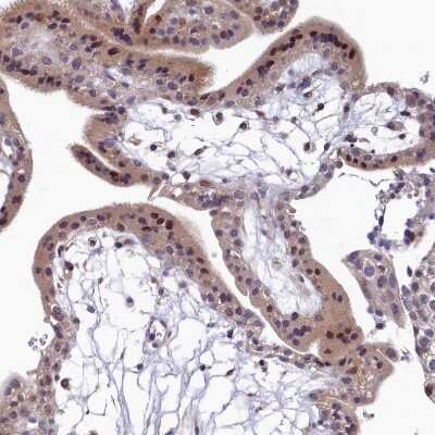 Immunohistochemistry-Paraffin: LATS2 Antibody [NBP2-14184]
