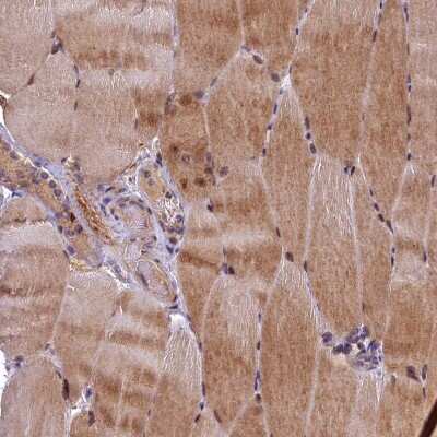 Immunohistochemistry-Paraffin: LATS2 Antibody [NBP2-14184]