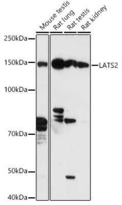 Western Blot: LATS2 AntibodyAzide and BSA Free [NBP3-03913]