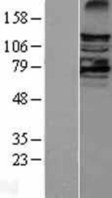 Western Blot: LATS2 Overexpression Lysate [NBL1-12449]