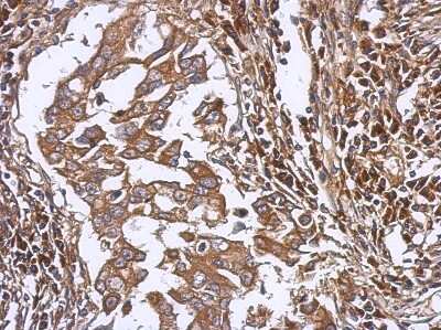 Immunohistochemistry-Paraffin: LAX1 Antibody [NBP2-19335]