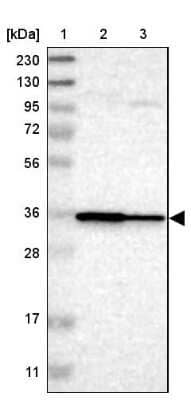 Western Blot: LAX1 Antibody [NBP1-83662]