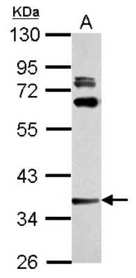 Western Blot: LAX1 Antibody [NBP2-19335]