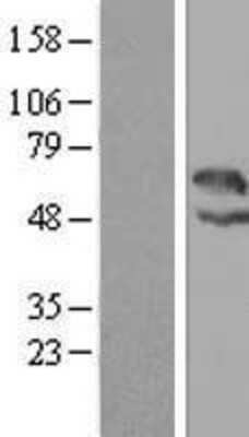 Western Blot: LAX1 Overexpression Lysate [NBP2-06919]