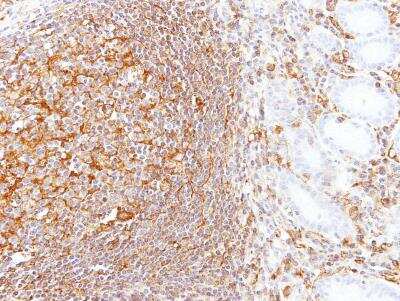 Immunohistochemistry-Paraffin: LBP Antibody [NBP1-32407]