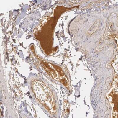 Immunohistochemistry-Paraffin: LBP Antibody [NBP1-88371]