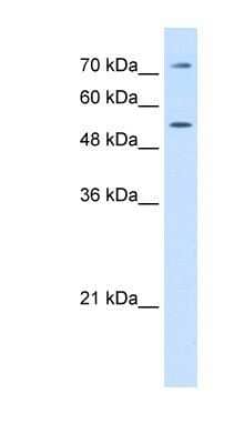 Western Blot: LBP Antibody [NBP1-58972]