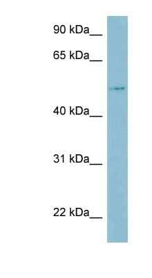 Western Blot: LBP Antibody [NBP1-58973]