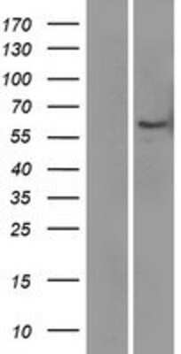 Western Blot: LBP Overexpression Lysate [NBP2-07906]