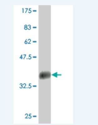 Western Blot: LBX1 Antibody (2A9) [H00010660-M02]