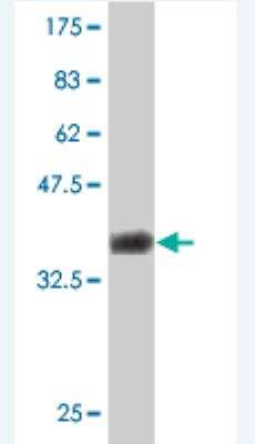 Western Blot: LBX1 Antibody (2F8) [H00010660-M03]