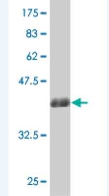 Western Blot: LBX1 Antibody (4E1) [H00010660-M04]