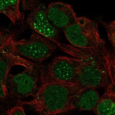 Immunocytochemistry/ Immunofluorescence: LBX1 Antibody [NBP2-55646]