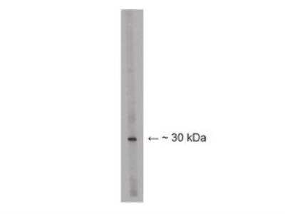 Western Blot: LBX1 Antibody [NBP2-29859]