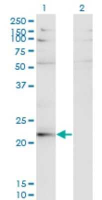 Western Blot: LBX2 Antibody (3A5) [H00085474-M02]