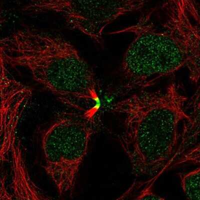 Immunocytochemistry/ Immunofluorescence: LBX2 Antibody [NBP2-14186]