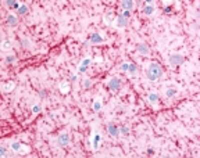 Immunohistochemistry: LC3 Antibody Pack [NB910-40435]