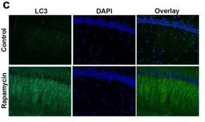 Immunohistochemistry: LC3 Antibody Pack [NB910-40435]