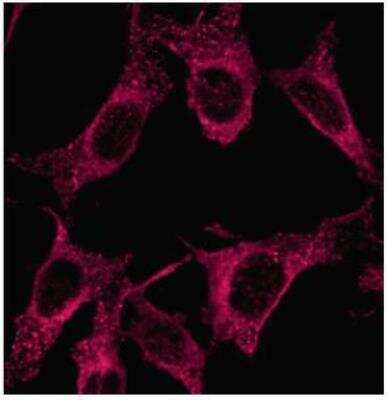 Immunohistochemistry: LC3 Antibody Pack [NB910-40435]